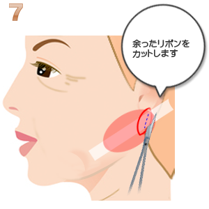 リボンリフト:余ったリボンのカット